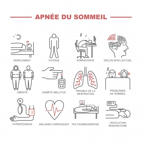 Apnée du sommeil